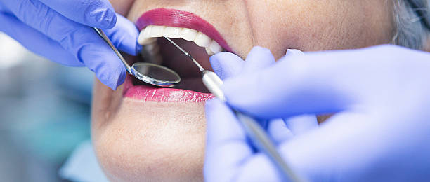 Best Emergency Dentist for Lost Fillings or Crowns in Erie, CO